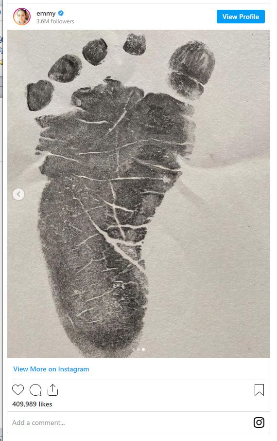 『オペラ座の怪人』エミー・ロッサムのマタニティフォト（3枚目）