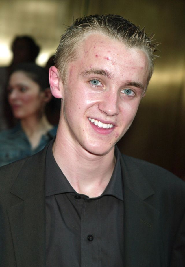 急激に成長！マルフォイ役トム・フェルトンの17年間（6枚目）