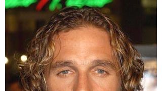 マシュー・マコノヒー、トレーニング中に顔を縫うケガ