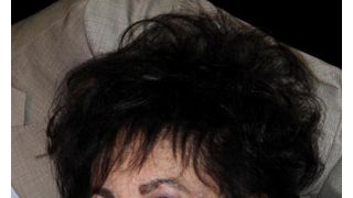 78歳のエリザベス・テイラー、うっ血性心不全で入院　一切の手術を拒否