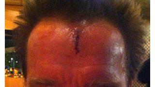 シュワちゃんが撮影中にケガ　額から血を流している写真をツイッターで発信