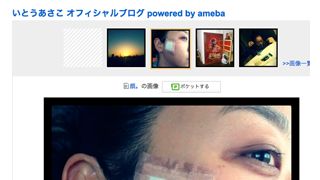 いとうあさこ、顔をやけど!「『女優は顔が命』なのに」…