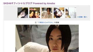 SKE48松井珠理奈が退院　復帰時期は未定…「まだ完全に回復したわけじゃないんです」