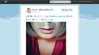 きゃりーぱみゅぱみゅ、転倒で顔を3針縫うケガ