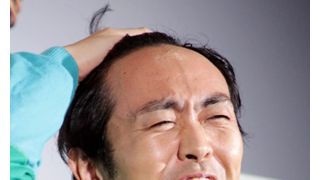 アンガ田中、全身整形で“キムタク”に?