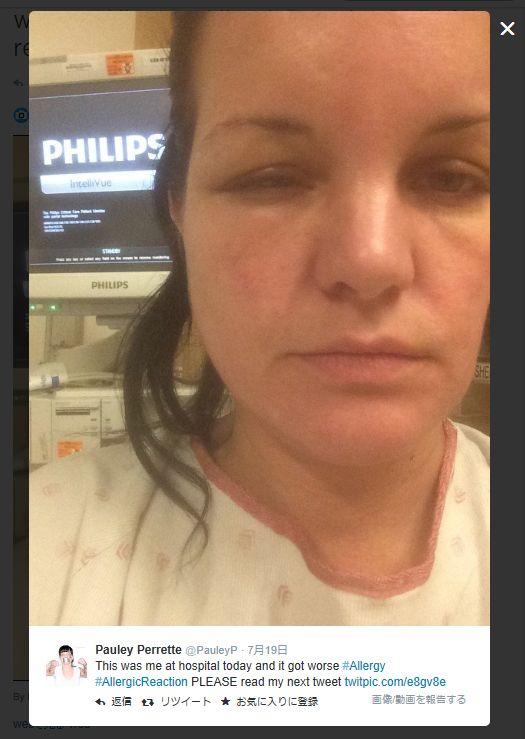 「NCIS」のアビー、ヘアカラーアレルギーで顔が腫れ上がる