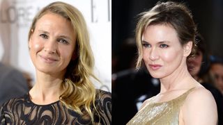 整形失敗?『ブリジット・ジョーンズ』女優の激変ぶりがヤバイ!
