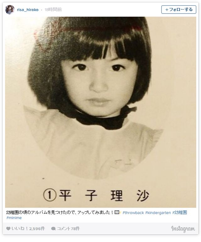 平子理沙、幼稚園時代の写真が「お人形さんみたい」「超絶美少女」と話題