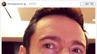 ヒュー・ジャックマン、皮膚がん再び　術後写真を公開