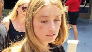 ジョニー・デップ離婚原因はDV？アンバーの顔にあざ