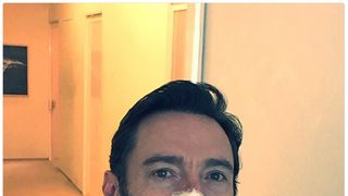 ヒュー・ジャックマン　皮膚がん再発