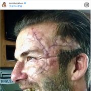 デヴィッド・ベッカムが傷だらけ 映画出演で別人に