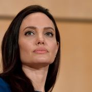 アンジェリーナ・ジョリー、ベル麻痺を患っていた
