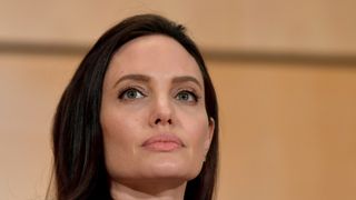 アンジェリーナ・ジョリー、ベル麻痺を患っていた