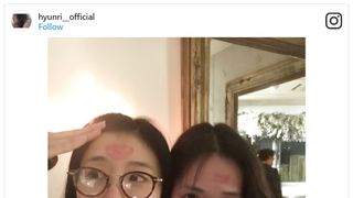 戸田恵梨香、親友に激しめのキス!キスマークだらけに
