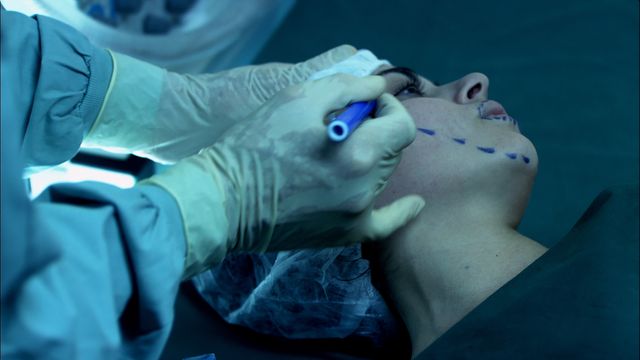 伝説が日本で美しく蘇る！『ムカデ人間 4K』フォトギャラリー（5枚目）