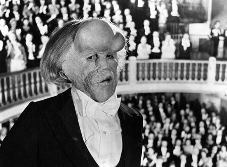 映画『エレファント・マン』の画像（6枚目）