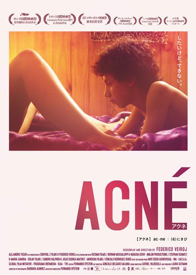 映画『アクネ ACNE』の画像（2枚目）