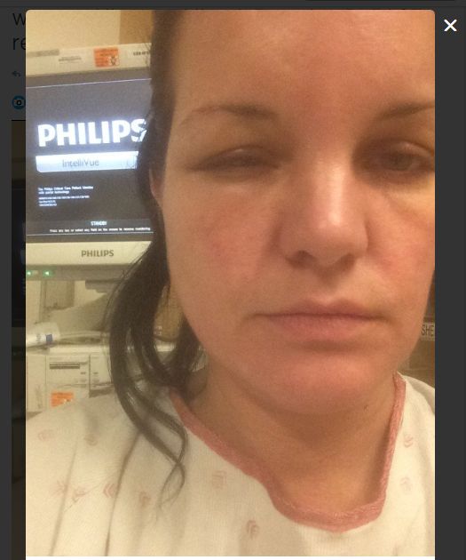 Ncis のアビー ヘアカラーアレルギーで顔が腫れ上がる シネマトゥデイ