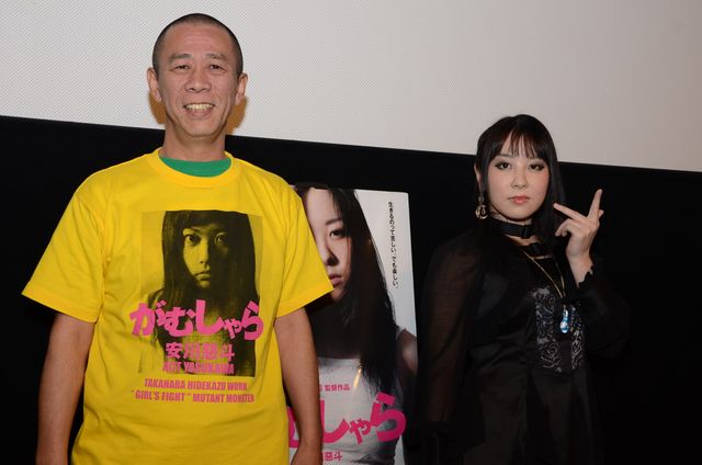 【写真】“顔面崩壊”騒動の安川惡斗、包帯とれる！フォトギャラリー：フォトギャラリー