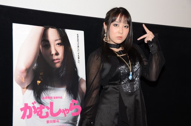 【写真】“顔面崩壊”騒動の安川惡斗、包帯とれる！フォトギャラリー（4枚目）